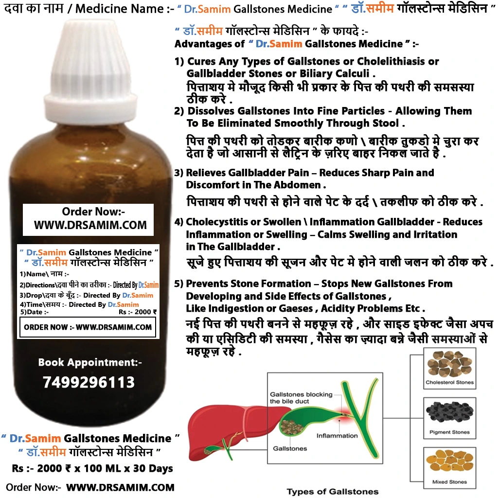 Dr.Samim Gallstones Medicine
