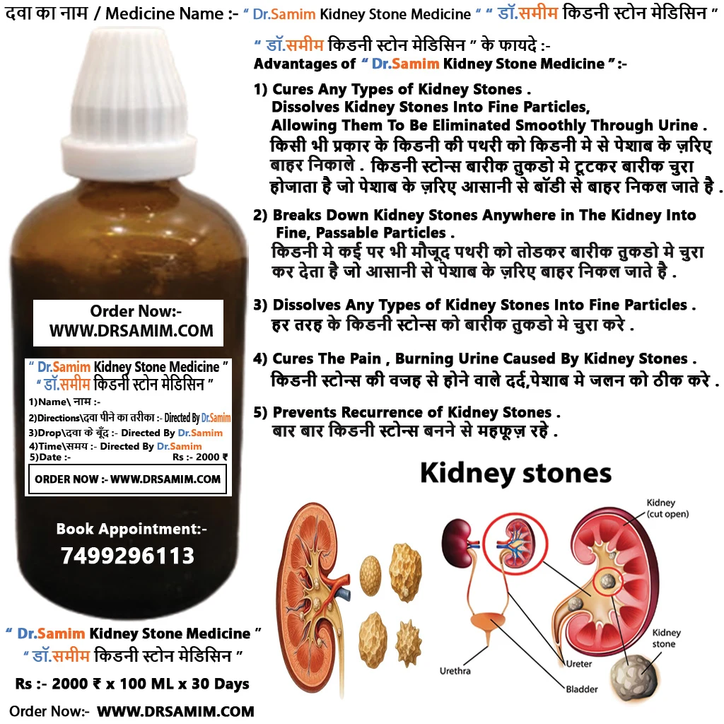 Dr.Samim Kidney Stone Medicine